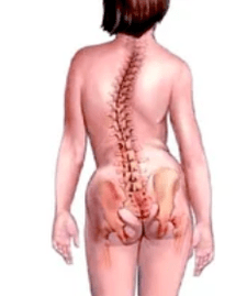 Musculoskeletal system pathology