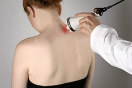 Treatment of cervical osteochondrosis with laser therapy
