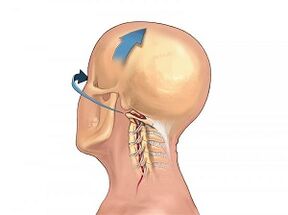 As cervical spine osteochondrosis manifests