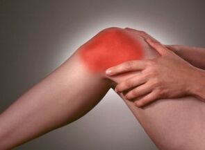 The symptom of arthrosis is an intense pain in the knee area